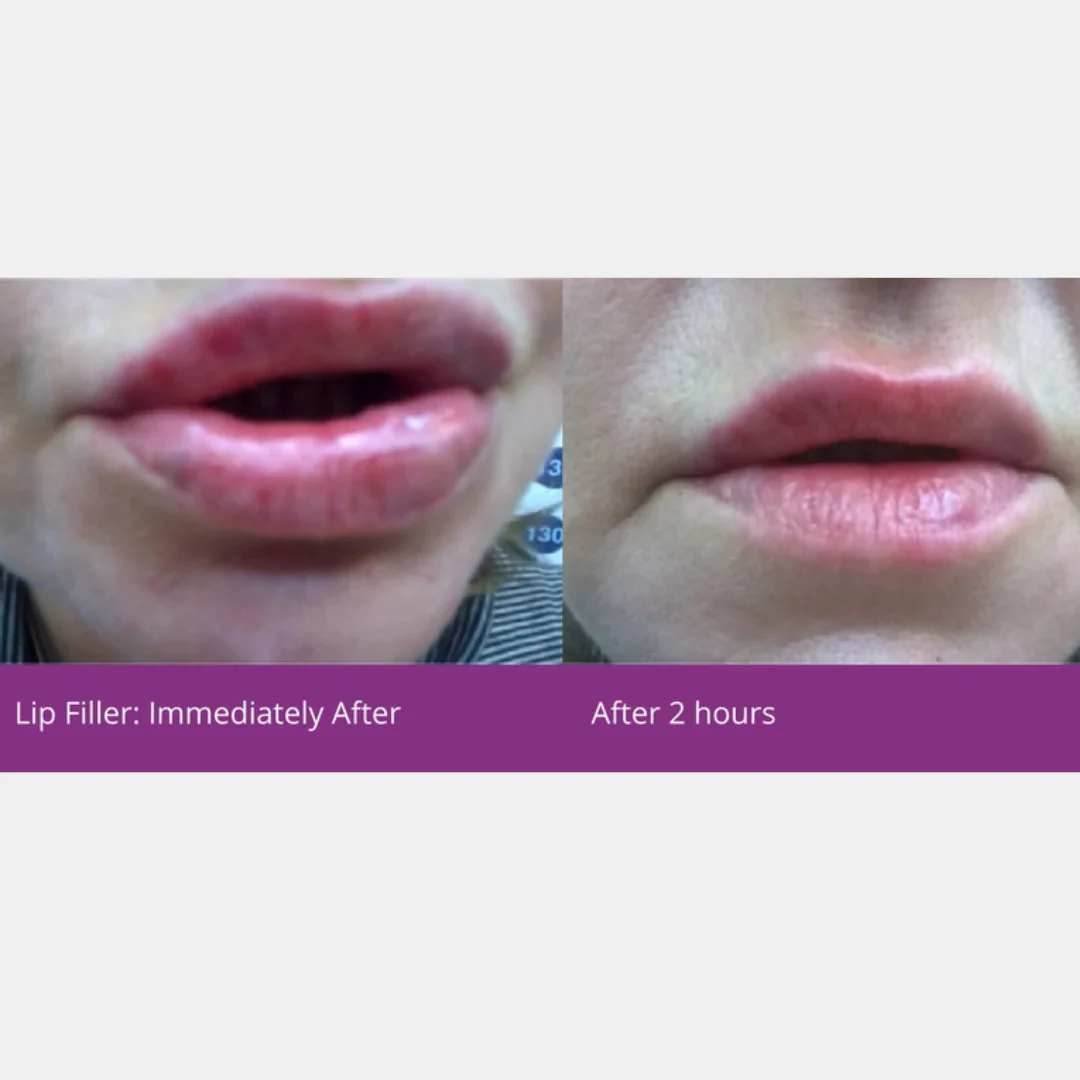 Cebelia LCE Balm 15ml - Image 5