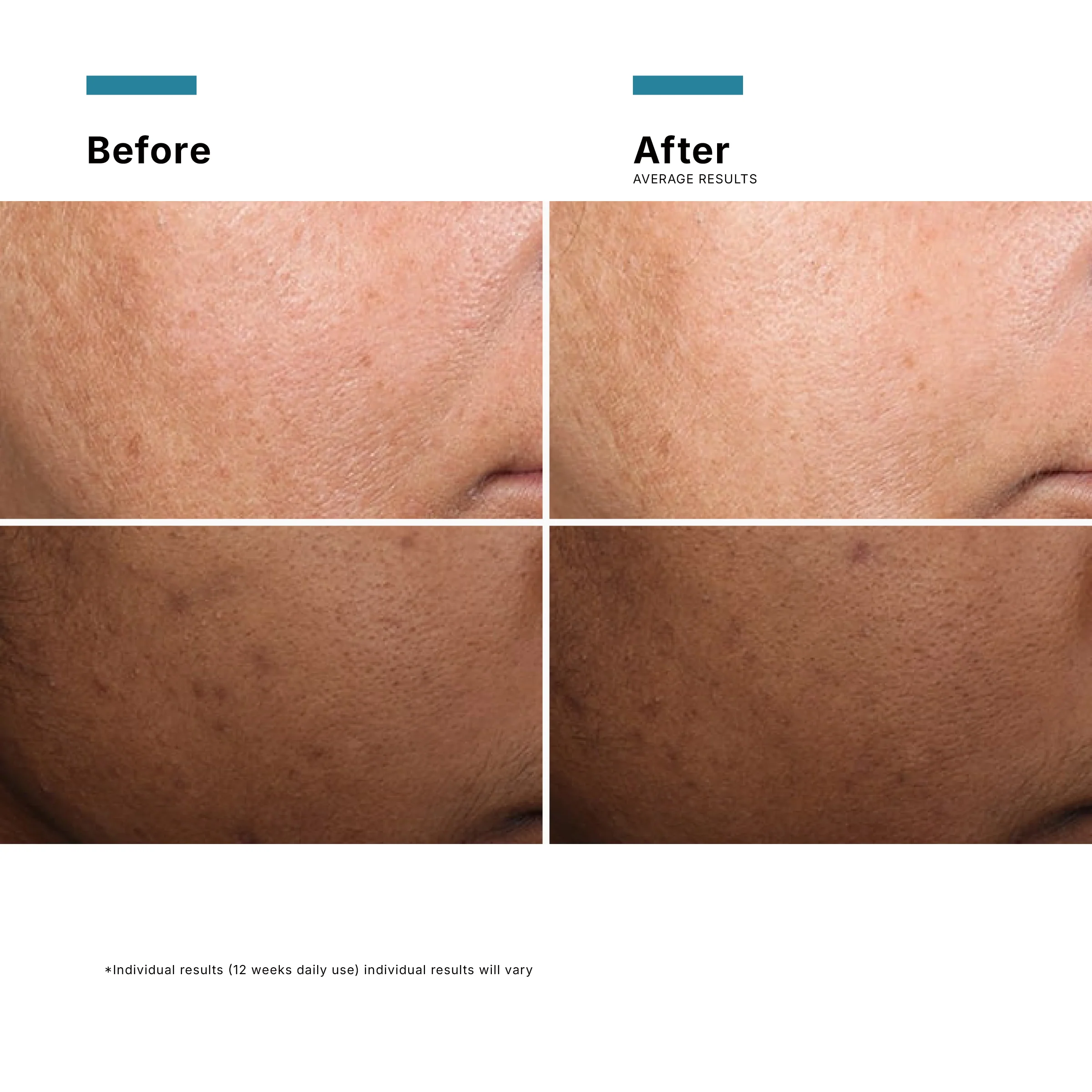 SkinCeuticals Discoloration Defense Serum 30ml - Image 17