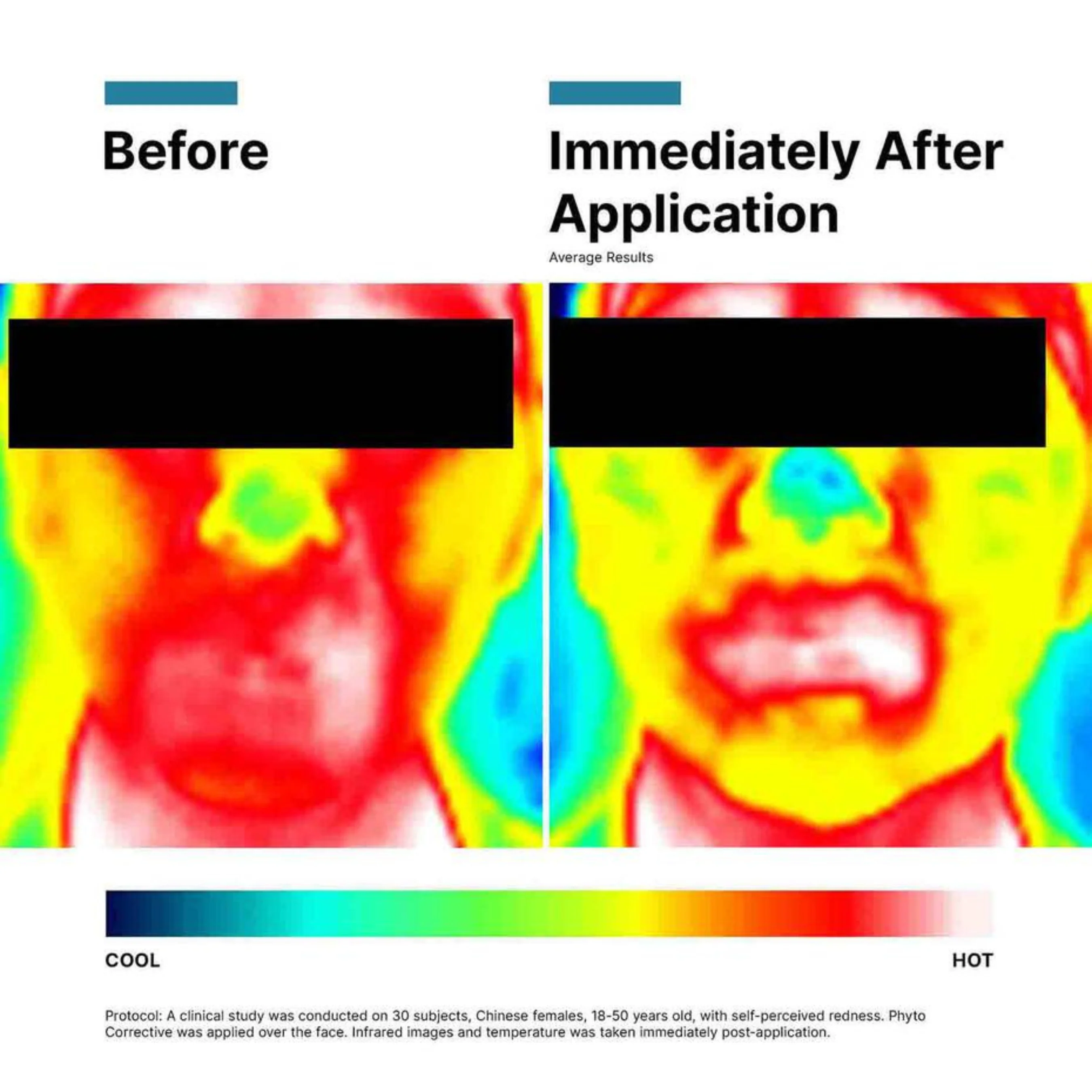 Skinceuticals Phyto Corrective Serum 30ml - Image 7