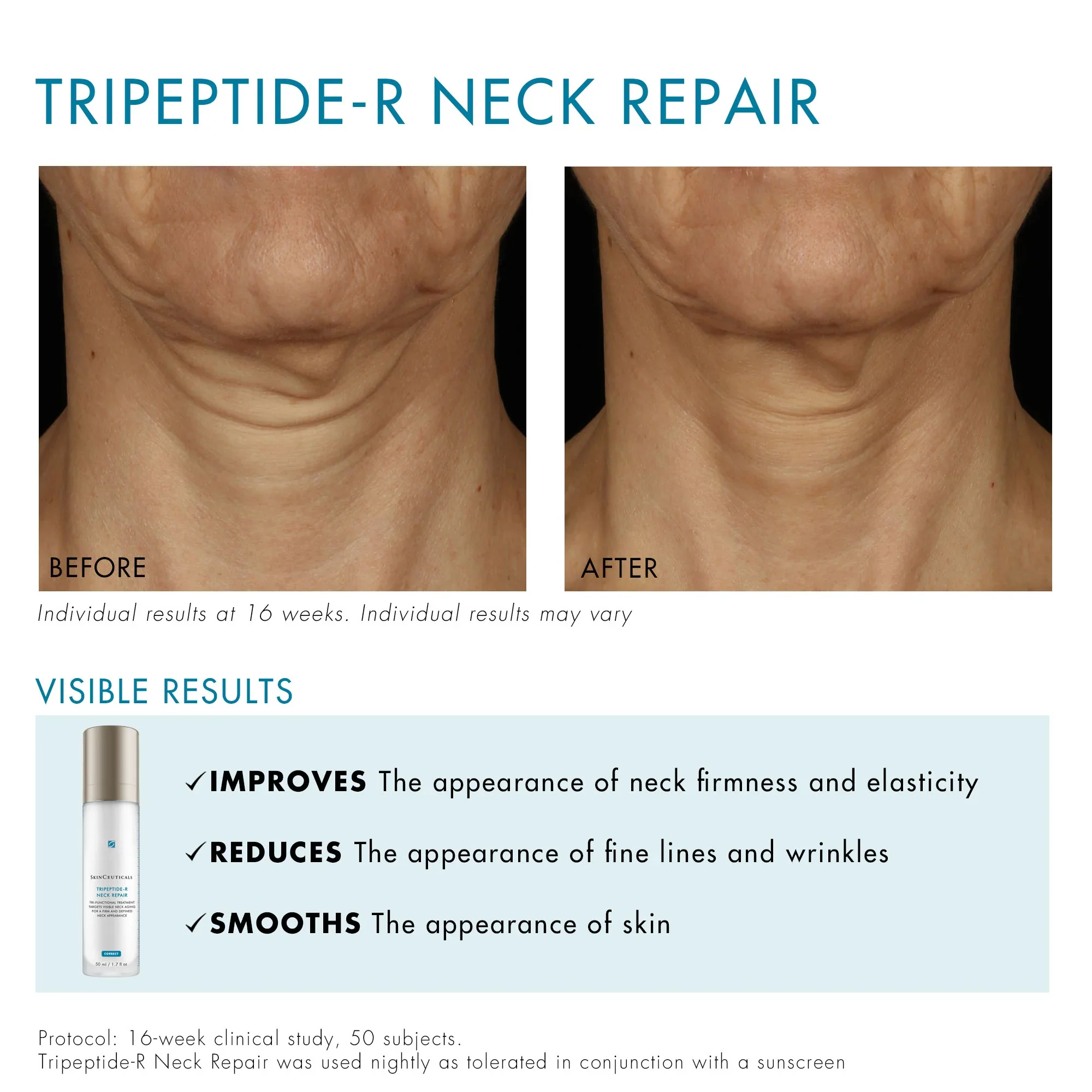 SkinCeuticals Tripeptide-R Neck Repair 50ml - Image 7